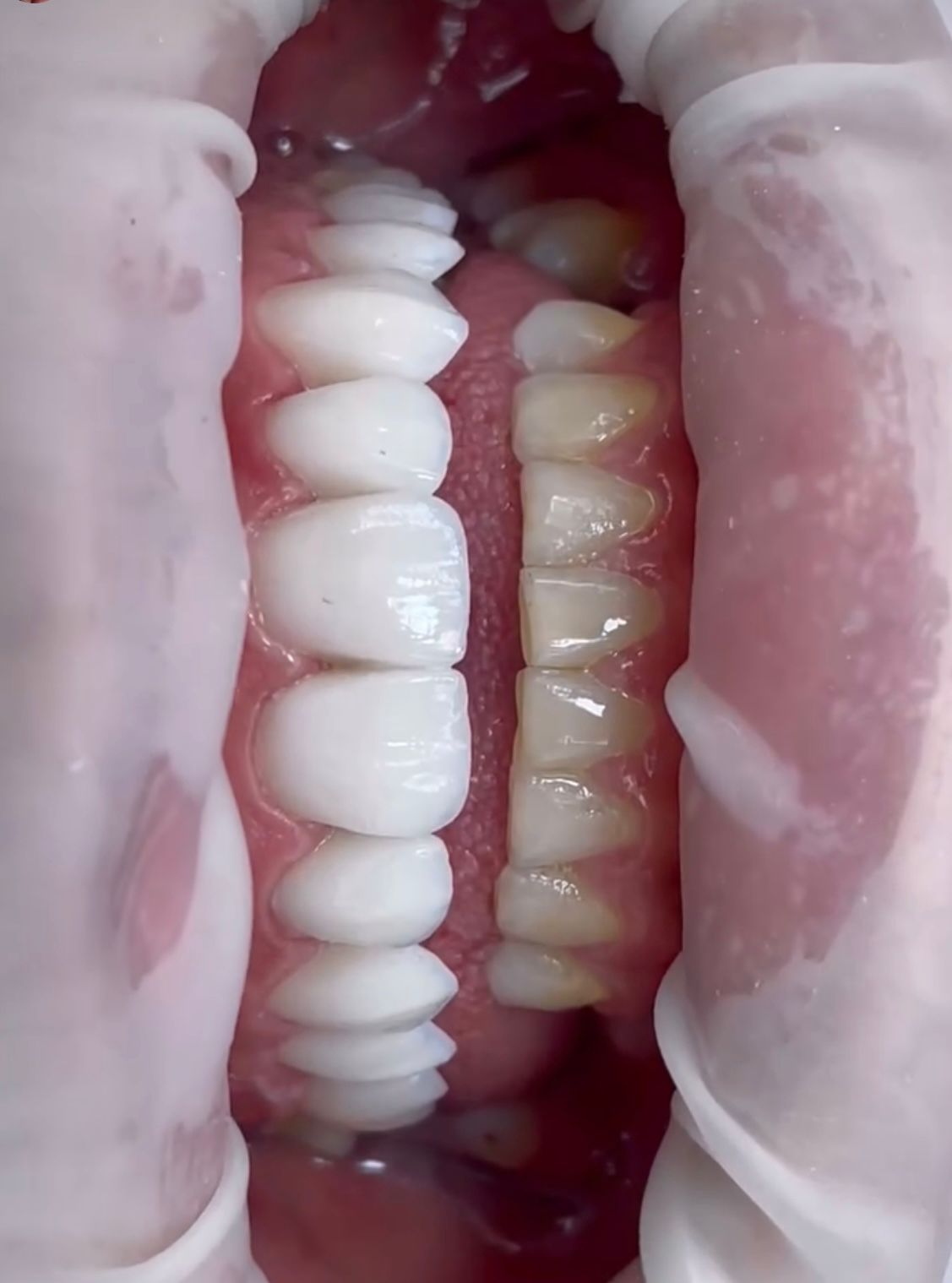 Harmonização facial